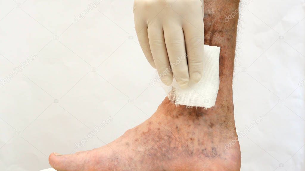 Human skin disease. Sanitary napkins on scars, ulcers, peelings 