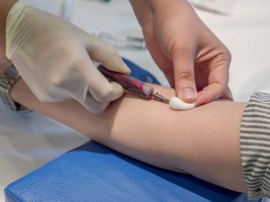 Gerçek kan örnekleri (Phlebotomist) 5 alarak hemşire