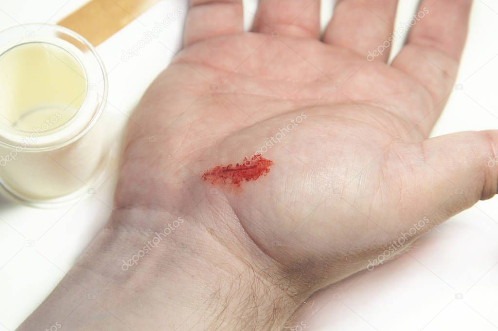 Bloody wound on mans hand