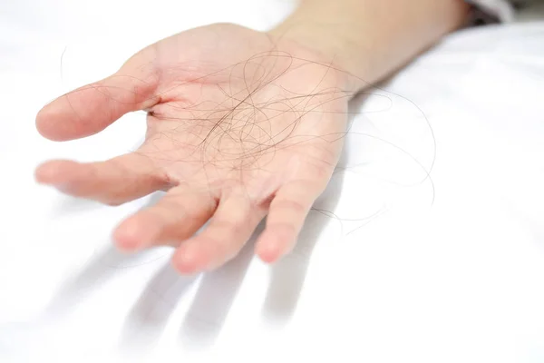 Many Hair Loss Hands Women White Background — Stock Photo, Image