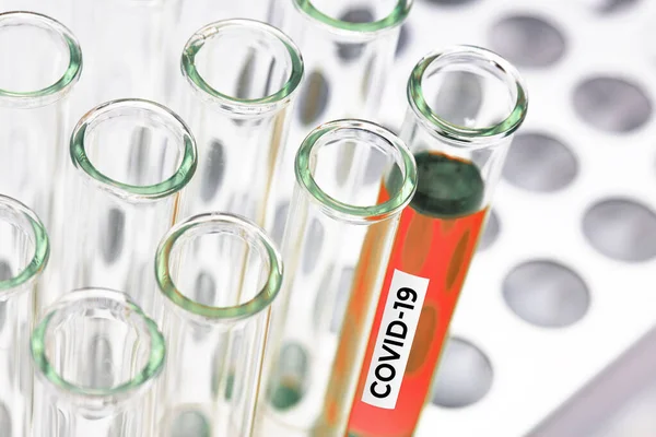 Covid Coronavirus Bemonstering Van Coronavirus Het Laboratorium — Stockfoto