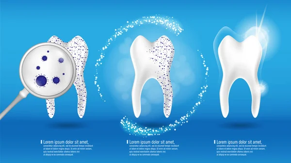 Концепція догляду за ротовою порожниною та стоматологічного здоров'я. Блискучий чистий і брудний зуб на синьому фоні, очищаючи зубний процес. Відбілювання та реставрація зубів. Векторні ілюстрації — стоковий вектор