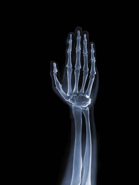 X-ışını anatomi kavramı