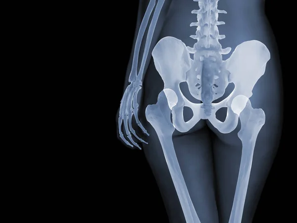 Concepto de anatomía de rayos X — Foto de Stock