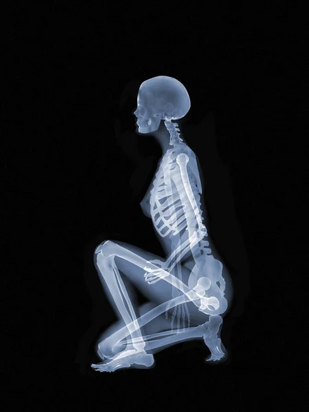 Concepto de anatomía de rayos X — Foto de Stock