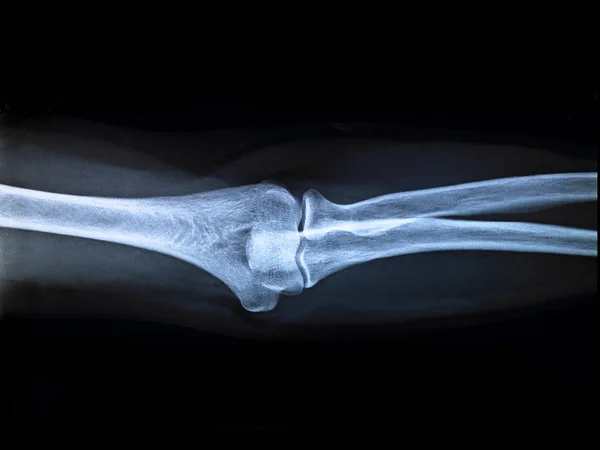 X-ray anatomy Concept — Stock Photo, Image