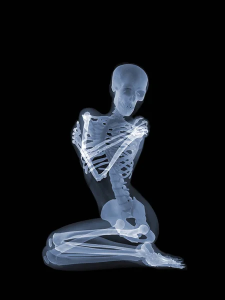 X-ray anatomy Concept — Stock Photo, Image