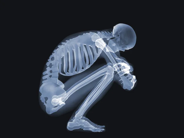 Röntgen-Anatomie-Konzept — Stockfoto