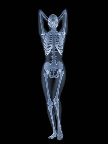 Concepto de anatomía de rayos X — Foto de Stock