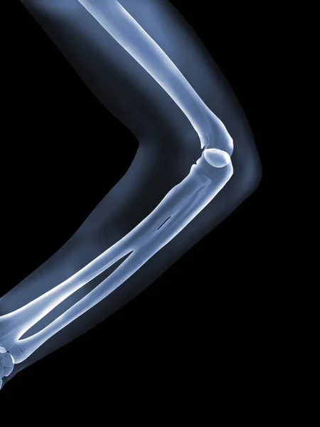 Рентгеновская анатомия — стоковое фото