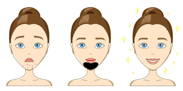 The sad face of a girl with pimples, with a black mask and after — Stock Vector