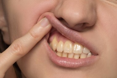 Sarı hatta ve çarpık dişleri genç bir kadın değil