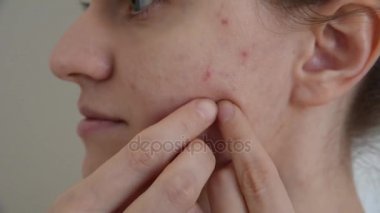 Güzel genç esmer kız darbeye ve çizikler beyaz ve kırmızı sivilce ve akne yüzünde beyaz bir arka plan üzerinde