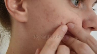 Güzel genç esmer kız darbeye ve çizikler beyaz ve kırmızı sivilce ve akne yüzünde beyaz bir arka plan üzerinde