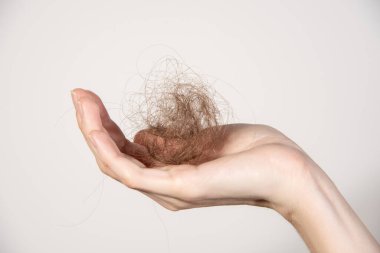Hair loss. Female hands with shreds of hair close-up clipart