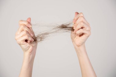 Saç dökülmesi. Saç telleri yakın planda olan kadın elleri.