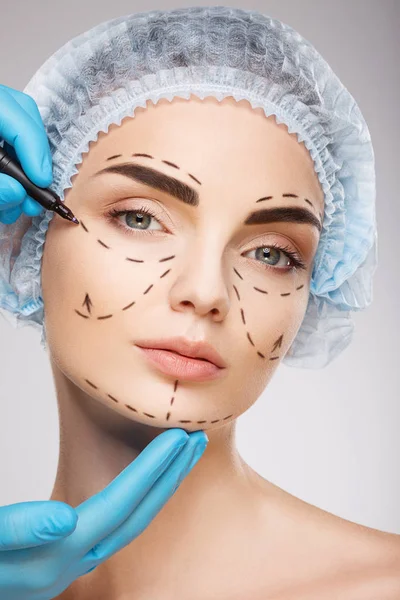 Lignes de perforation sur le visage du patient — Photo