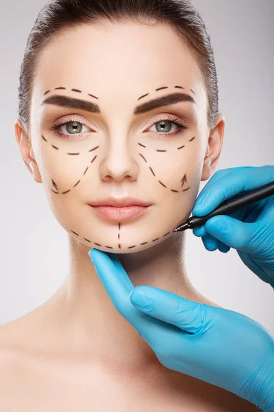 Lignes de perforation sur le visage du patient — Photo