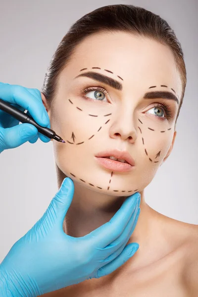 Lignes de perforation sur le visage du patient — Photo