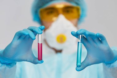 Doktorun kolunda koruyucu kıyafetli tıbbi sıvılar olan test tüpleri.