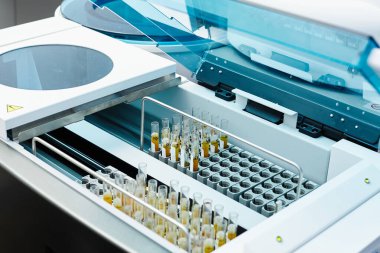 Test tüplerinde bulunan sarı örnekler özel buzdolabındaki kimya laboratuvarında.