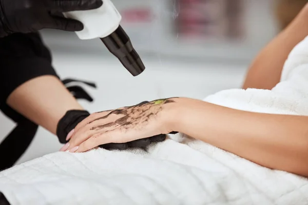 close-up of female arm with carbon mask receiving laser theraphy in beauty clinic