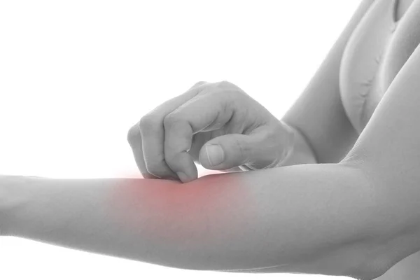 Comichão Doenças Pele Mulheres Usando Arranhão Mão Vermelho Redor Área — Fotografia de Stock