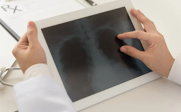 Radiograph — Stock Photo, Image