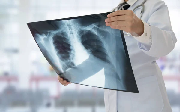 Doctor examining chest x-ray film — Stock Photo, Image