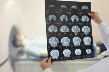 Doktor hastanın MRI taramasıyla beyin röntgenini inceler..