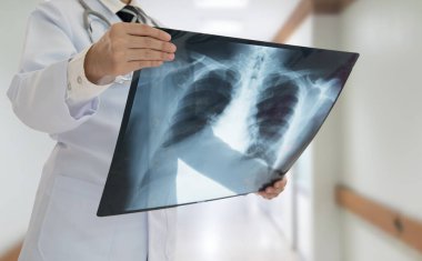 Hastanedeki hastanın göğüs röntgenini inceleyen doktor..
