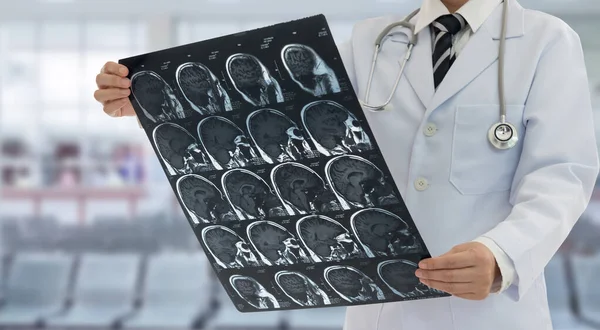 Doctor Examines Film Ray Brain Mri Scan Patient — Stock Photo, Image