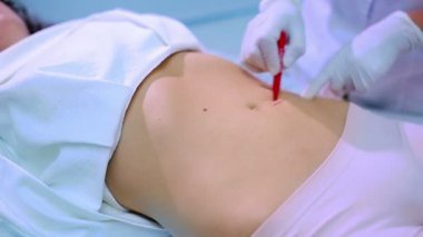 Orta yaşlı erkek kozmetik kliniğinde gövdesi içine kırmızı kalem kullanarak doktor