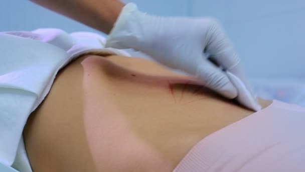 Врач Очищает Женскую Кожу Косметологической Клинике — стоковое видео