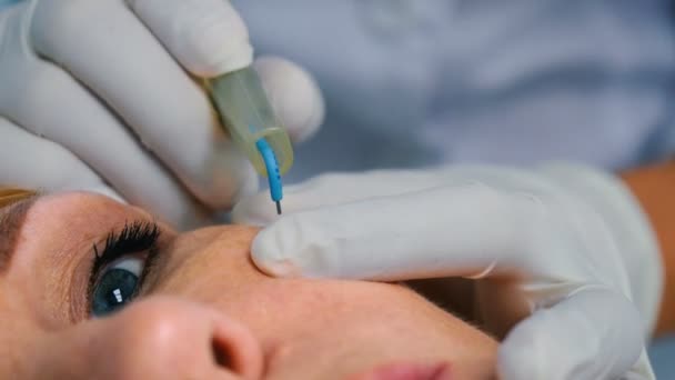 美容クリニックで金髪の中高齢者女性の顔に注射を行う医師 — ストック動画