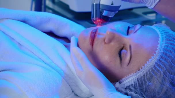 Arts Doet Laser Verjonging Van Huid Cosmetologie Kliniek — Stockvideo