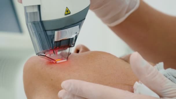 Médico Fazendo Rejuvenescimento Laser Pele Clínica Cosmetologia — Vídeo de Stock