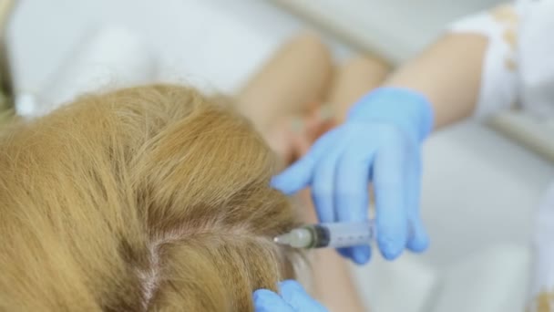 Lékař vloží kyseliny hyaluronové v kůži hlavy — Stock video