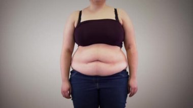 Yetişkin, tanınmayan obez kadın karnını geriyor ve dinleniyor. Şişman, beyaz kadın vücudu. Obezite, aşırı kilo problemi.