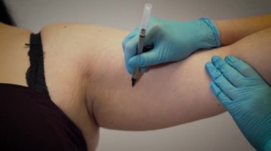 Plastik cerrah beyaz şişman kadın eline çizgiler çiziyor. Obez hasta estetik ameliyata hazırlanıyor. Liposuction, ilaç, selülit.
