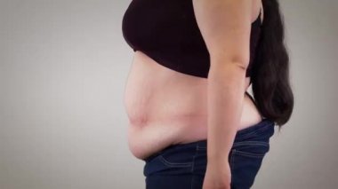 Dans eden şişman, beyaz bir kadının göbeğine yakın çekim. Obez pozitif kız eğleniyor. Aşırı kilolu, obezite, yaşam tarzı.