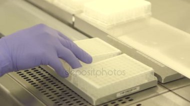 İdrar numuneleri depolama