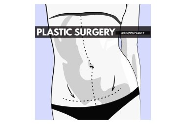  Plastik cerrahi. Vektör çizim.