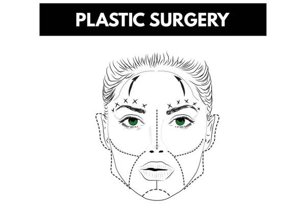 Cirurgia plástica. Ilustração vetorial . — Vetor de Stock