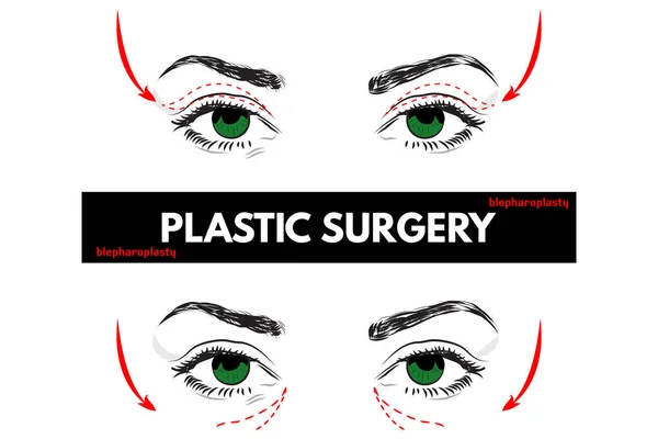 Chirurgia plastica. Illustrazione vettoriale . — Vettoriale Stock