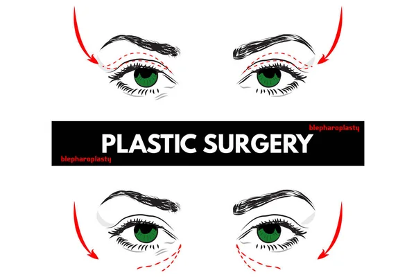 Plastische Chirurgie. Vektorillustration. — Stockvektor