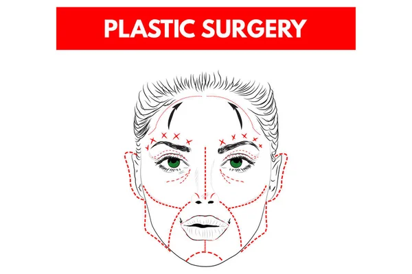 Plasztikai sebészet. Vektoros illusztráció. — Stock Vector
