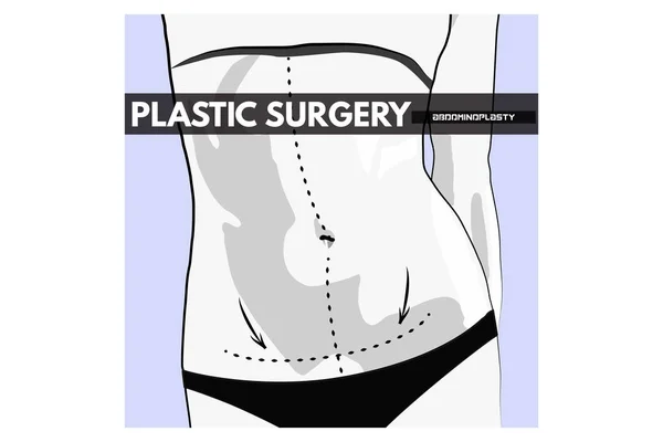 Chirurgie plastique. Illustration vectorielle . — Image vectorielle