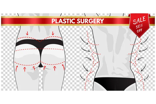 Пластическая хирургия. Коррекция тела . — стоковый вектор