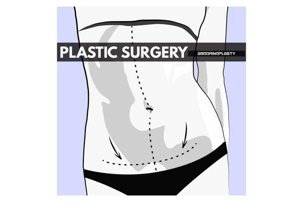 Plastische Chirurgie. Vektorillustration. lizenzfreie Stockillustrationen